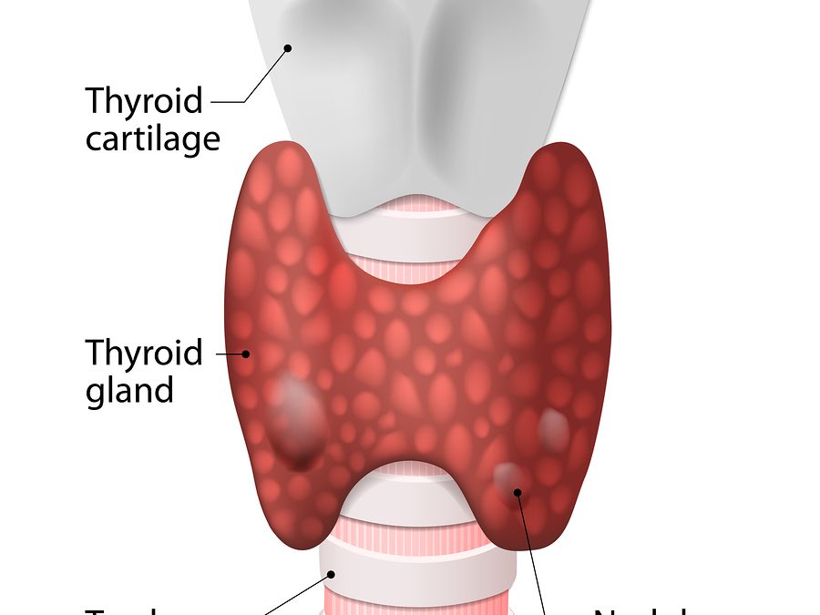 La tiroides