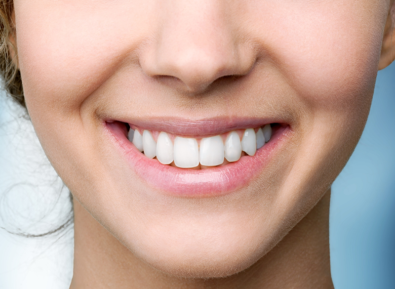 Hábitos sanos que pueden dañar tus dientes